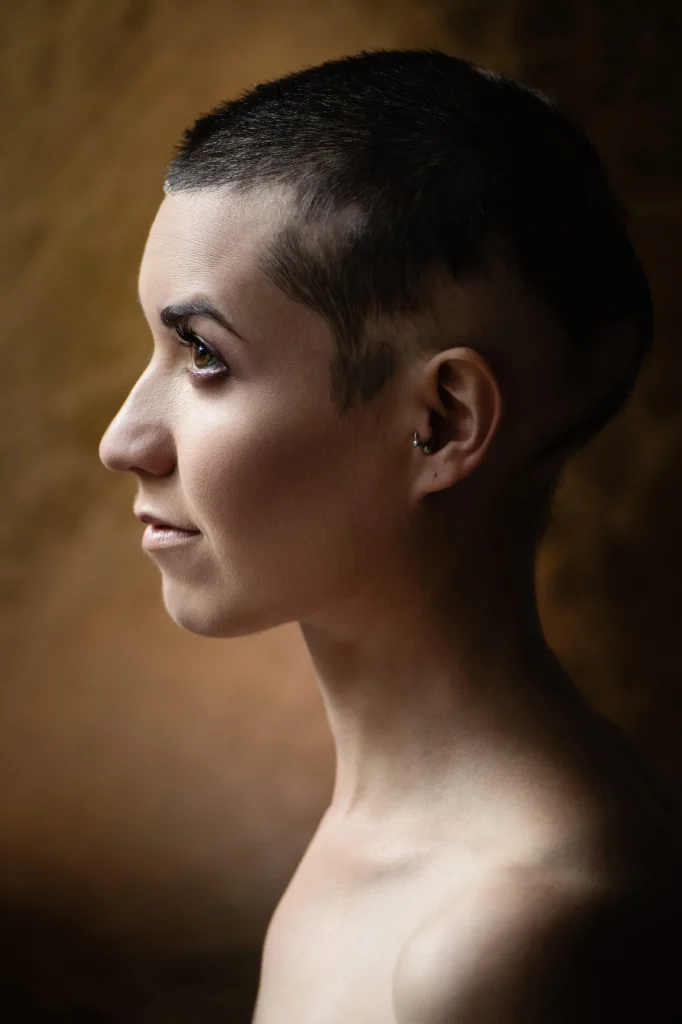 Person in profile showing short hair and visible scalp, illustrating androgenetic alopecia