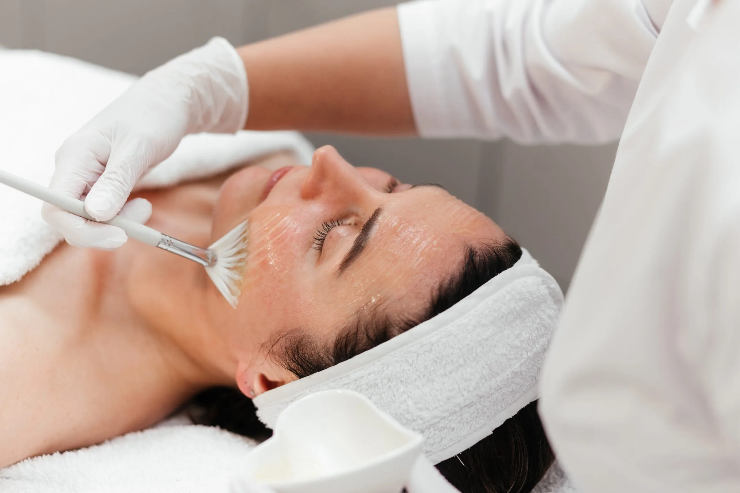 Clinician applying chemical peel solution to patient's face with brush during treatment