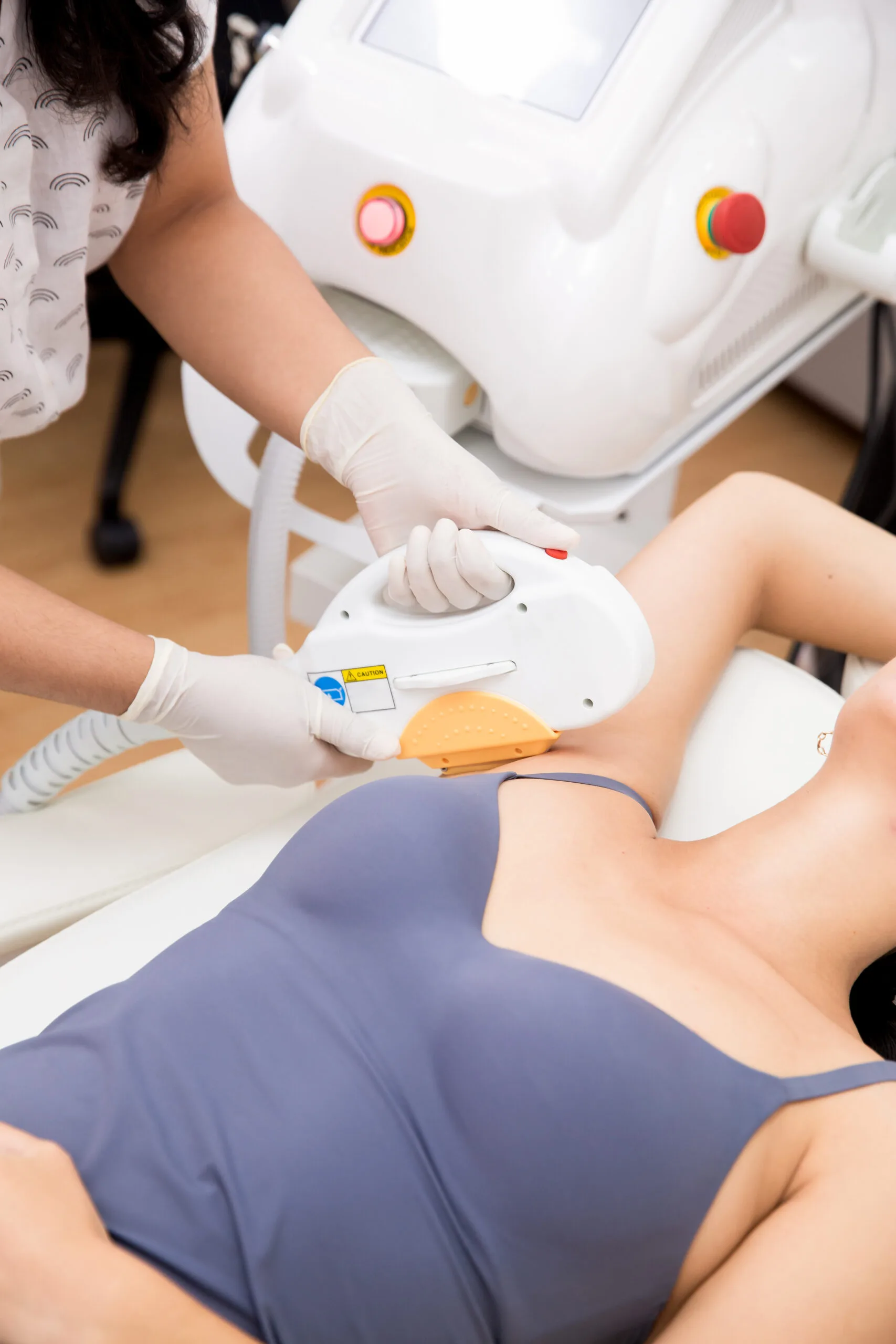 Clinician performing IPL treatment on a patient's leg using a handheld device with orange and red indicator lights