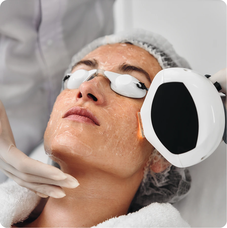 Dermatologist performing laser treatment on patient's face wearing protective eyewear