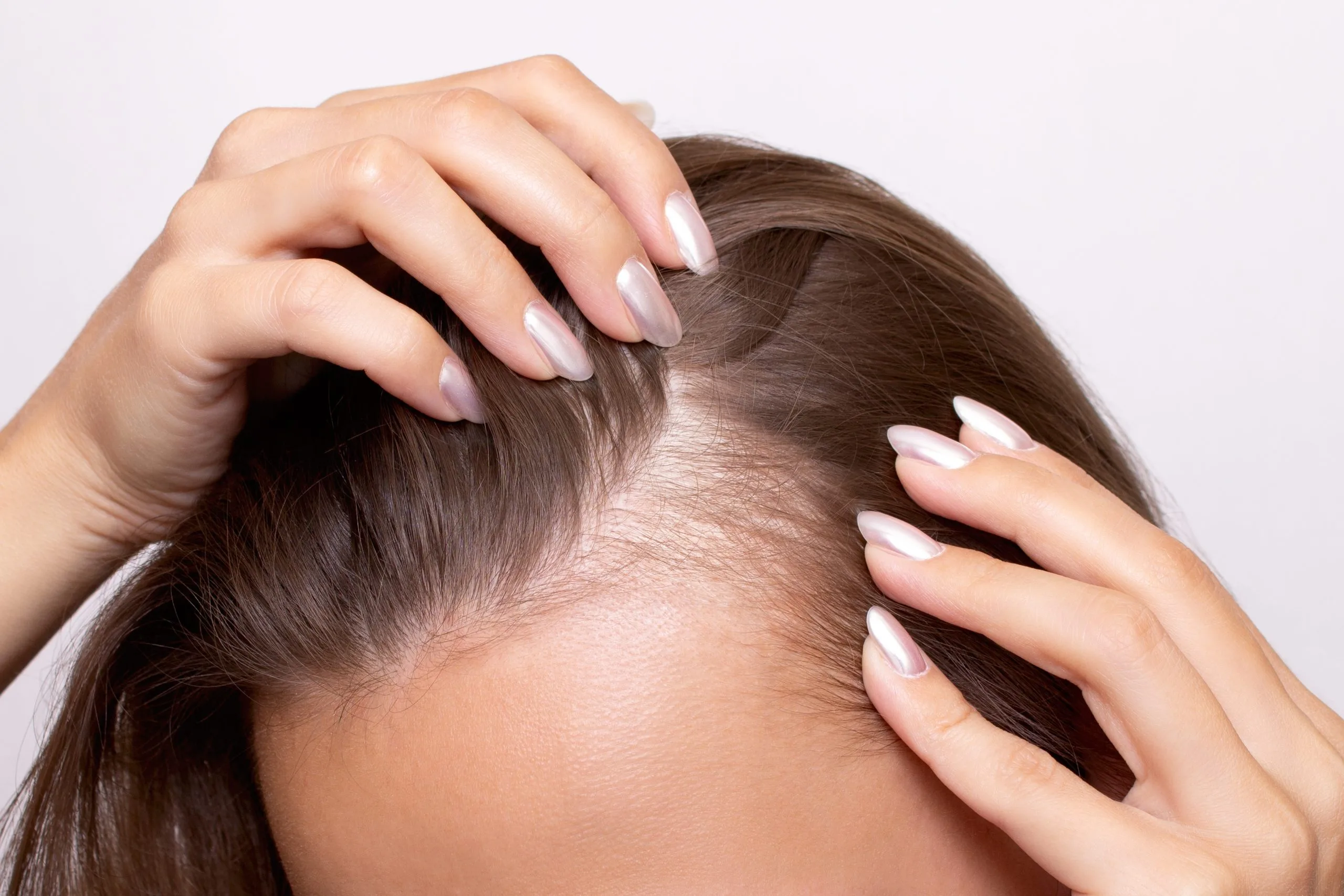 Woman parting her hair to show thinning at the part line, a common sign of female hair loss