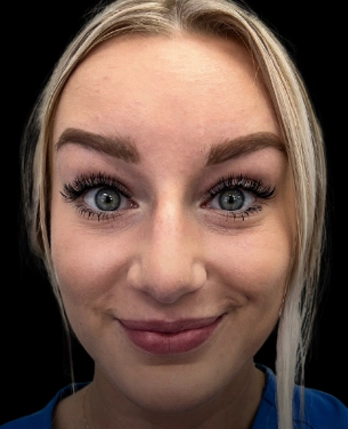 Woman's face showing smooth forehead and defined brows
