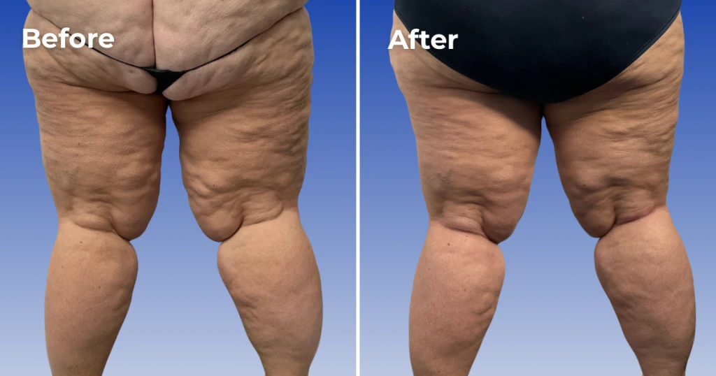 Weight Loss Management Ft Myers Florida