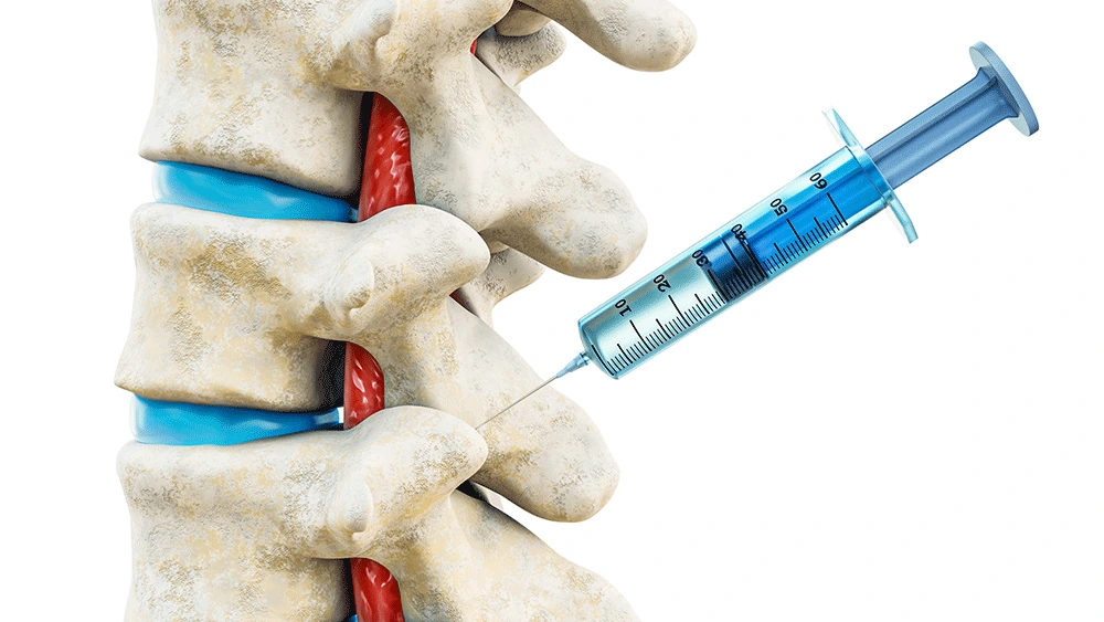 Facet Joint Injections