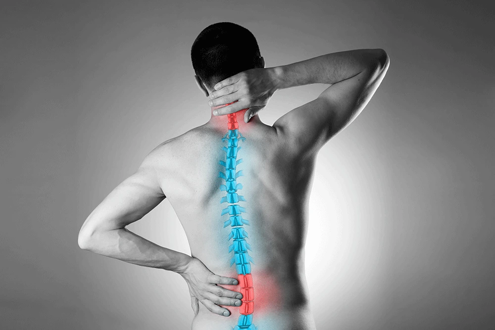 Facet joint syndrome