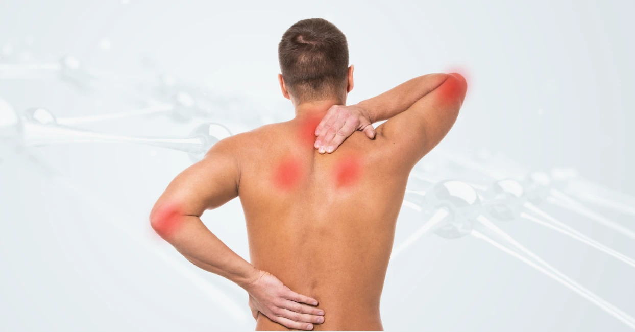 Fibromyalgia image