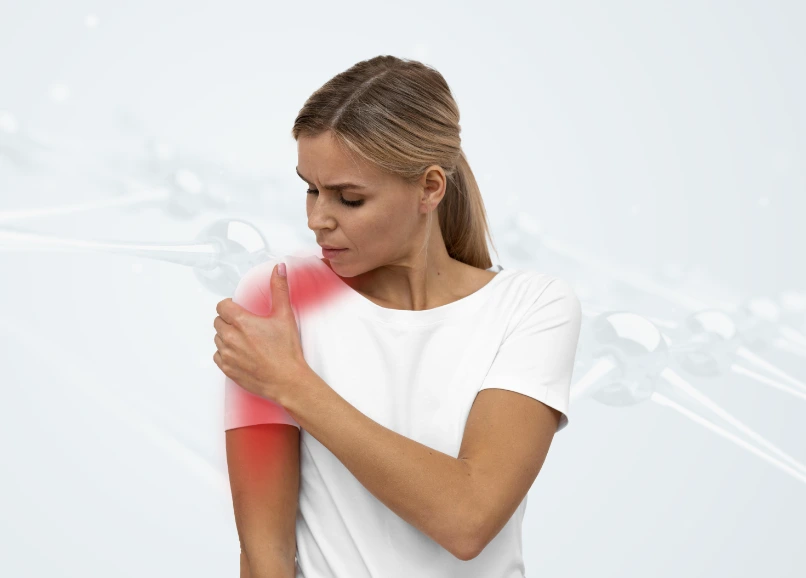 Radiculopathy image