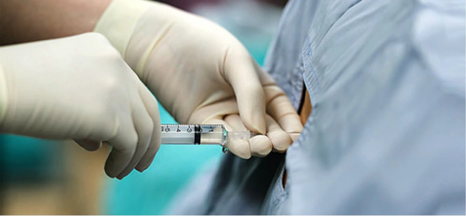 epidural