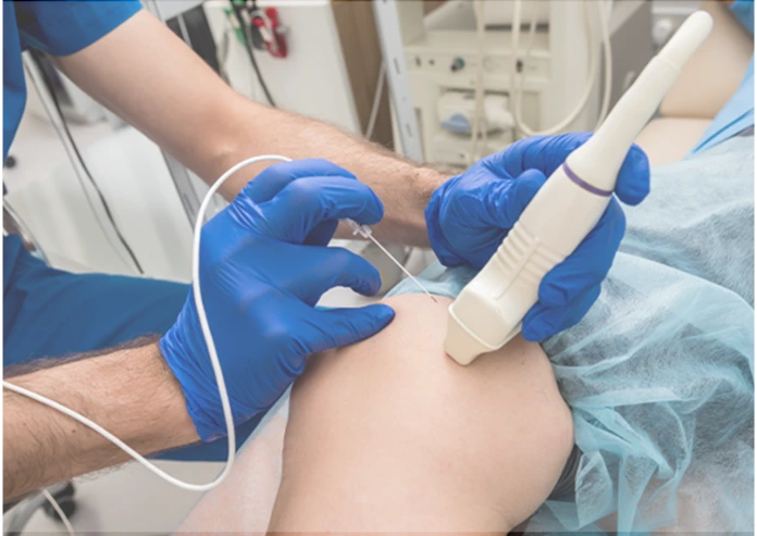 knee radiofrequency