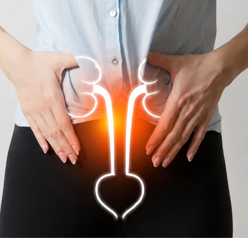 Illustration of urinary retention showing bladder and urinary tract with orange heat map highlighting affected area