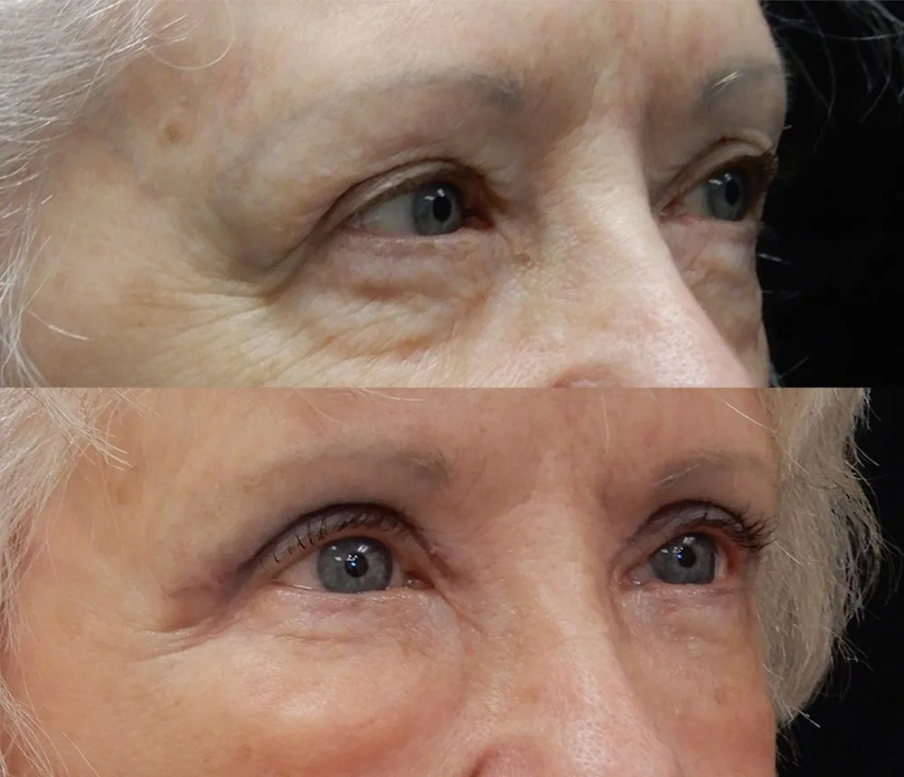eyes-rightangle