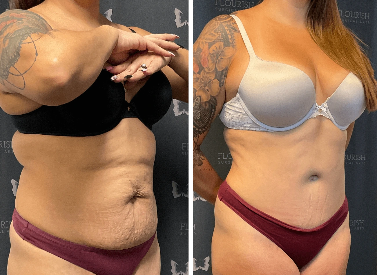 Lipo 1.1