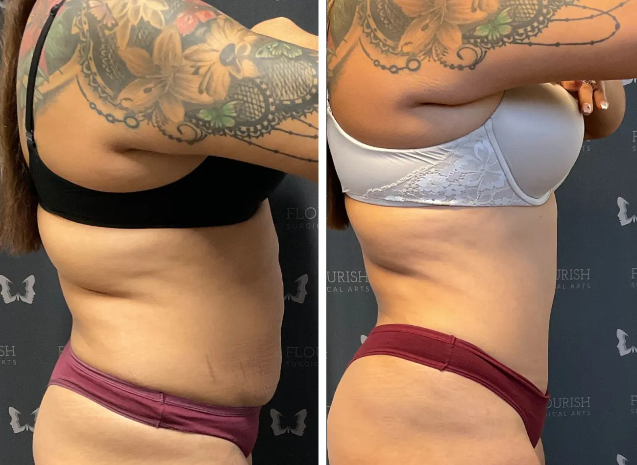 Lipo 1.2
