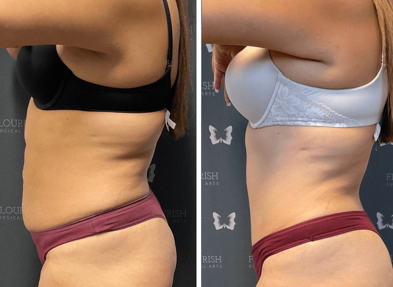Lipo 1.3