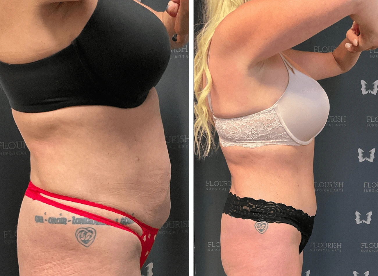 Lipo 2.3