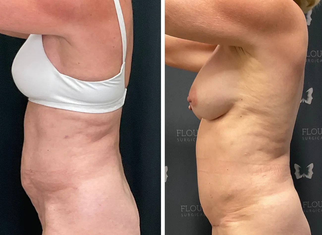 Lipo 3.3