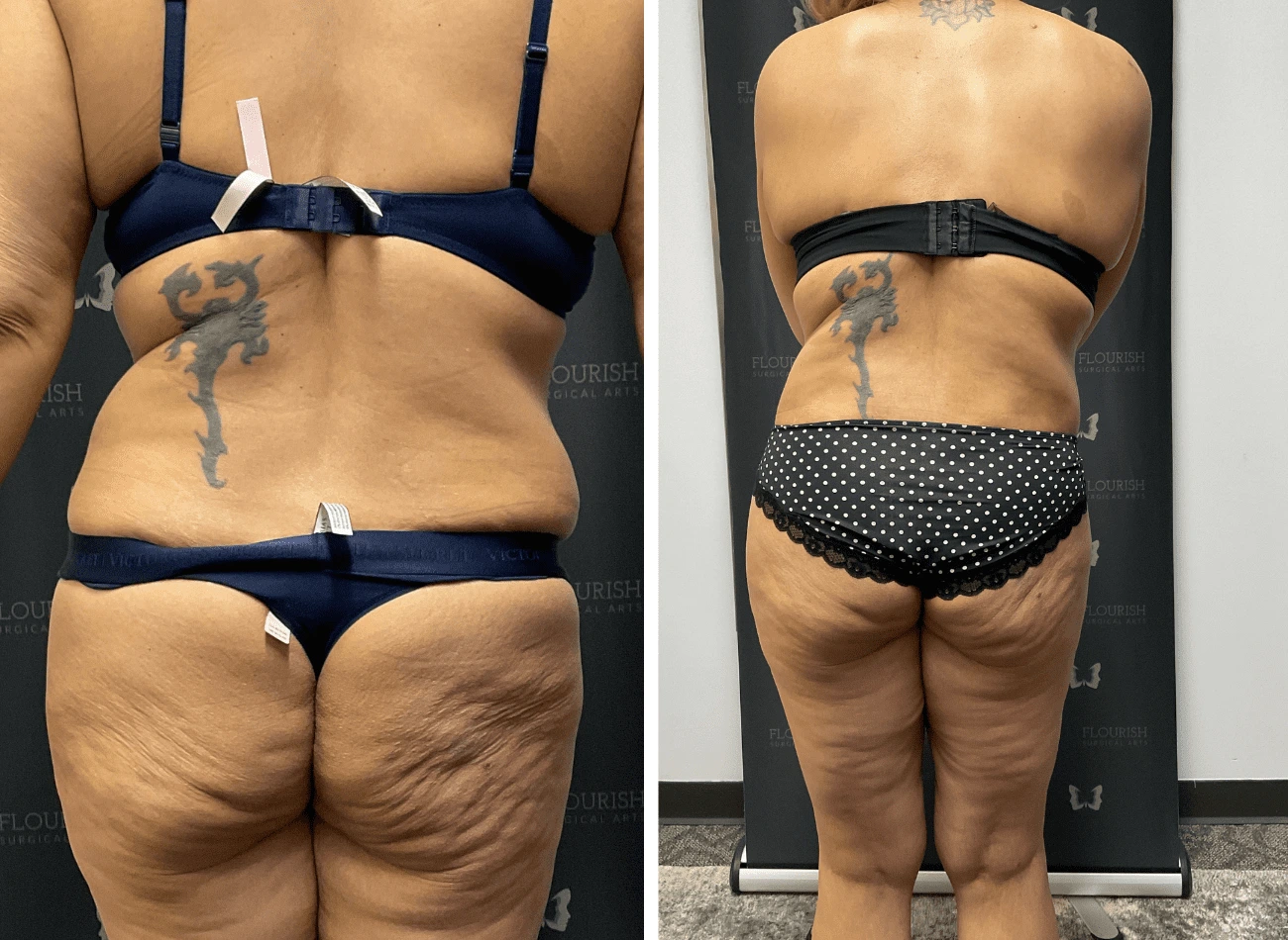 TT & Lipo 2.3