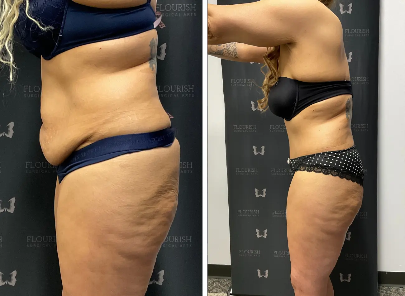 TT & Lipo 2.5