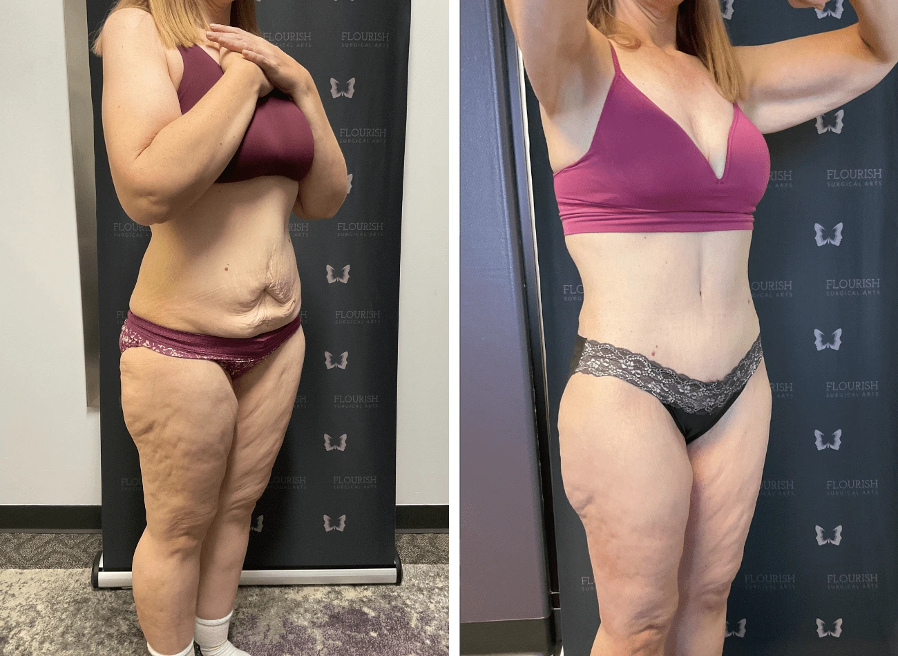 TT & Lipo 3.1