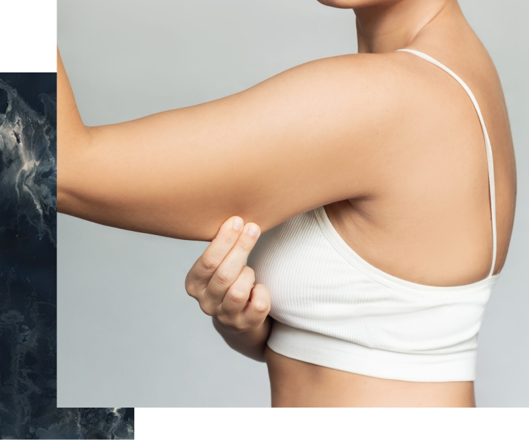 Arm Liposuction Scottsdale, AZ Banner