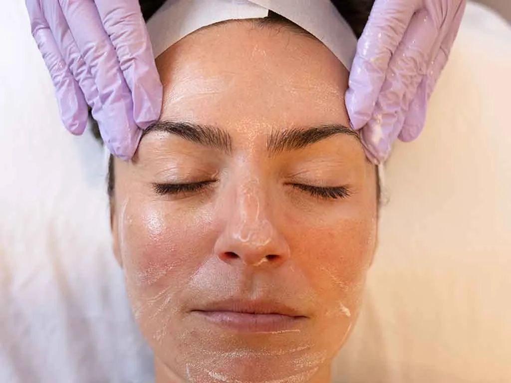 Esthetician in lavender gloves applying treatment product to patient's face