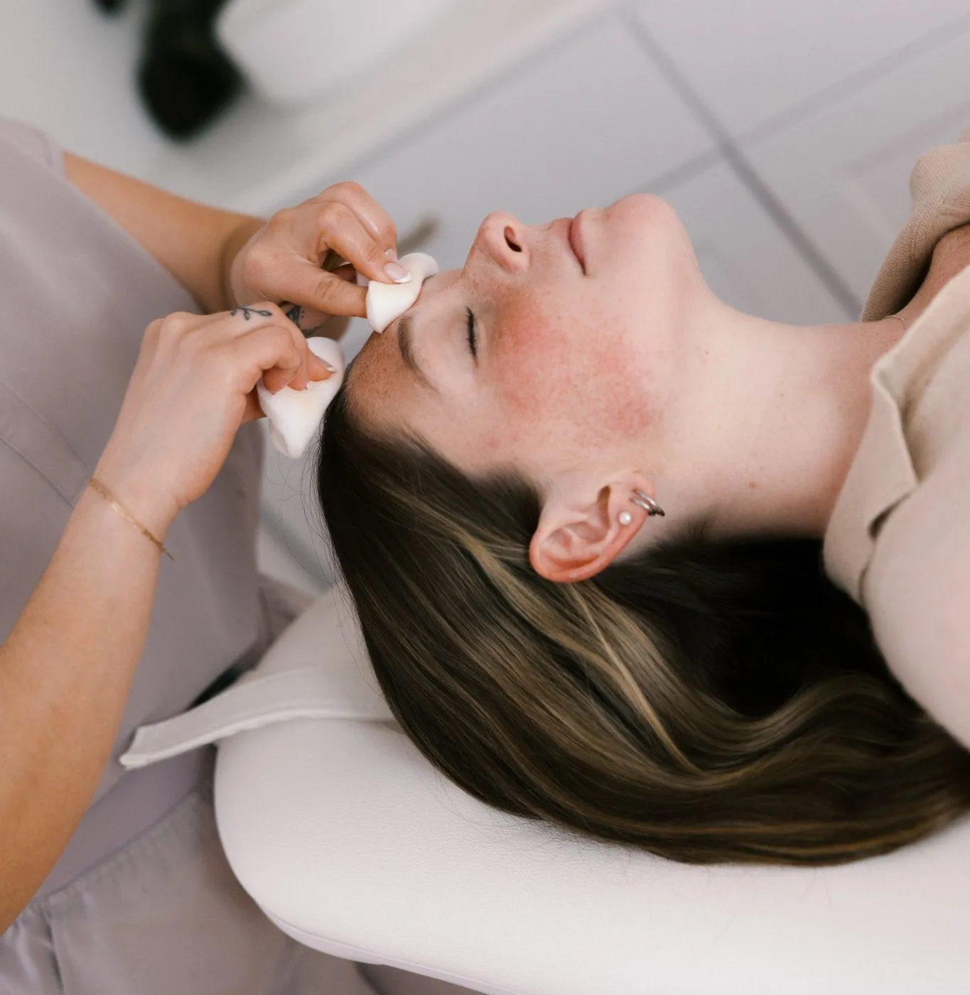 Provider applies chemical peel solution to patient's face during treatment