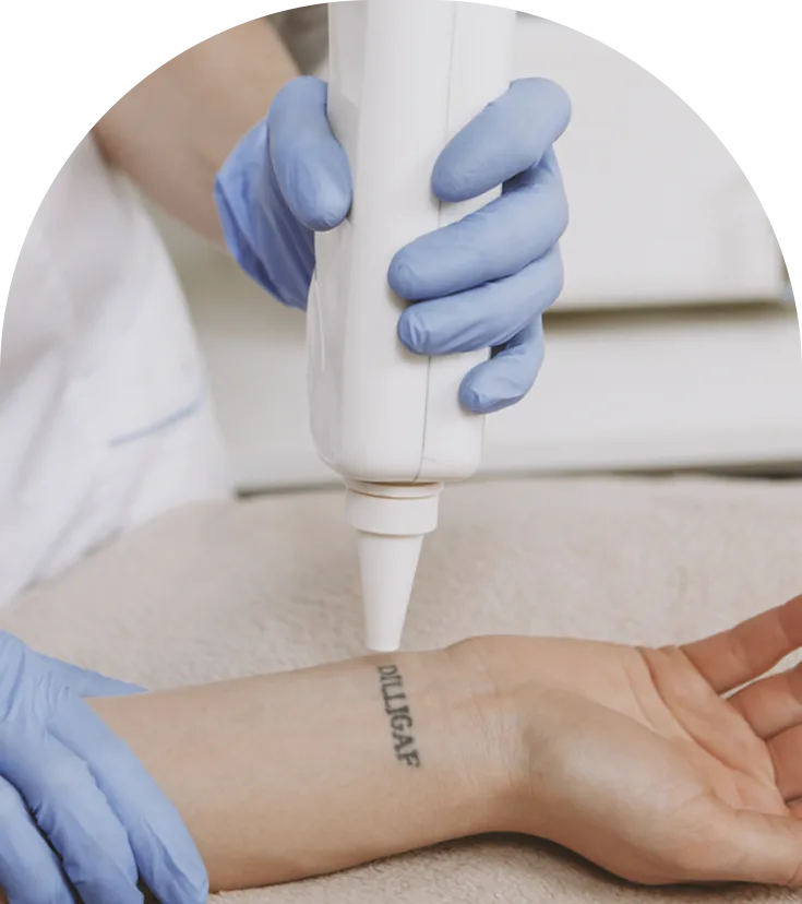 Practitioner in blue gloves applying injectable treatment to patient's forearm with handheld device