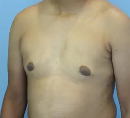 Case 10b after