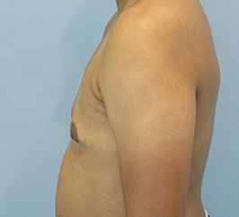 Case 10c after