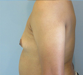 Case 10c before