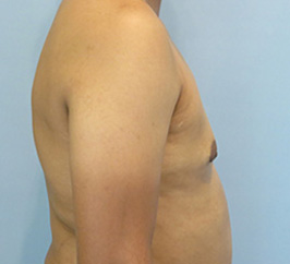 Case 10d after