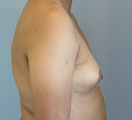 Case 10d before