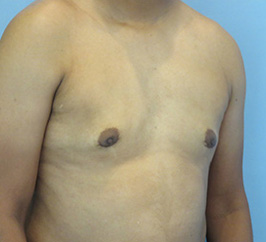 Case 10e after