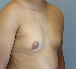 Case 10e before