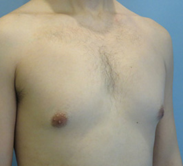Case 8C before