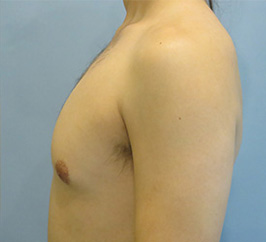 Case 8D before