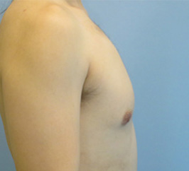 Case 8b before