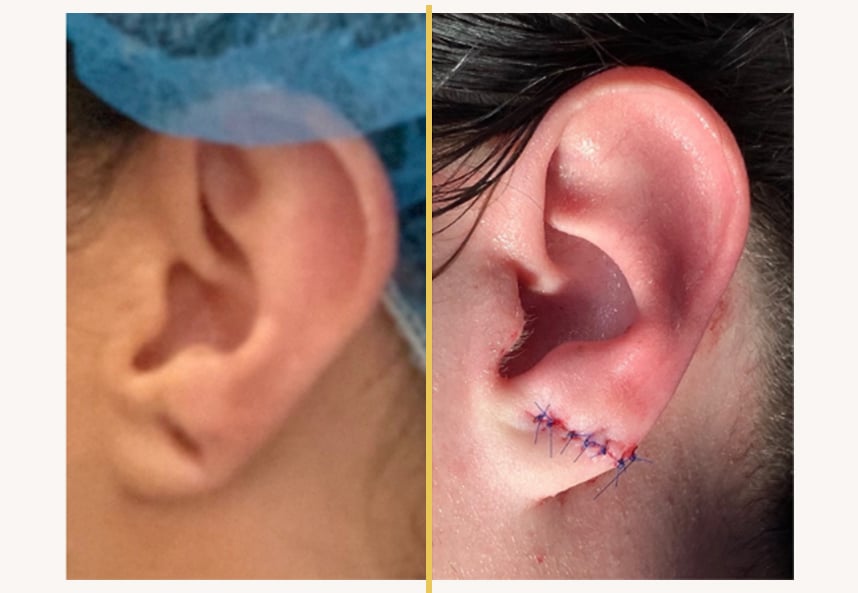 Case 053 2