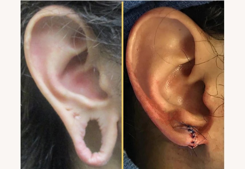 Case 062