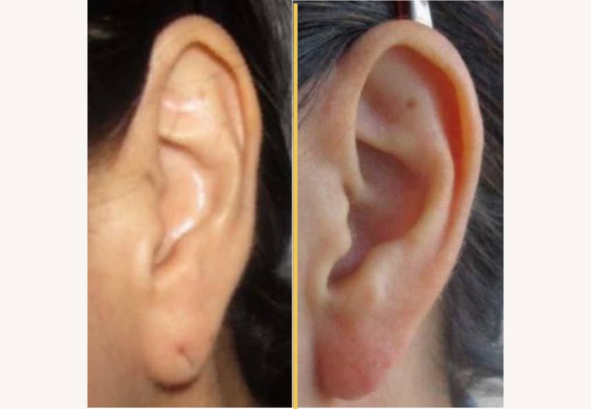 Case 064