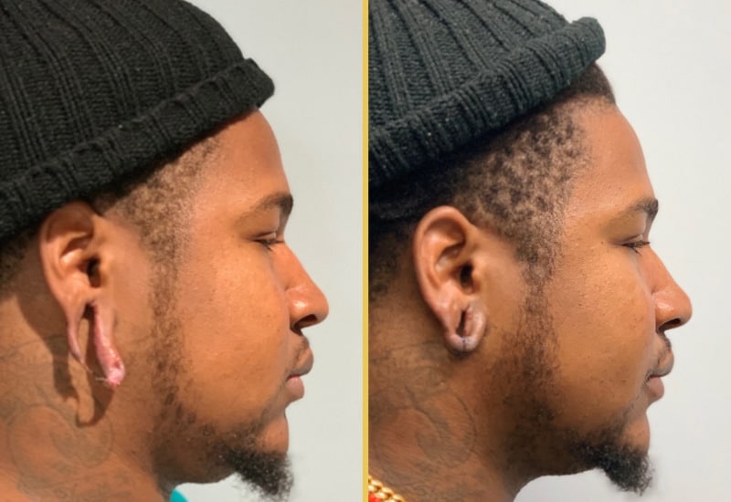 ear surgery 246 main