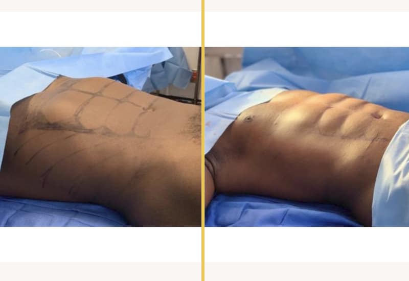 men ab silh redo