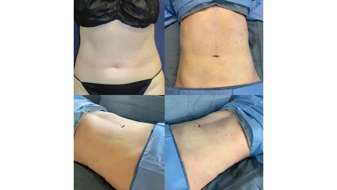Ab Silhouetch Female.pptx 127