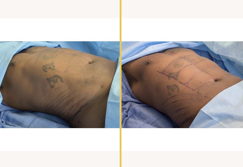 case 229