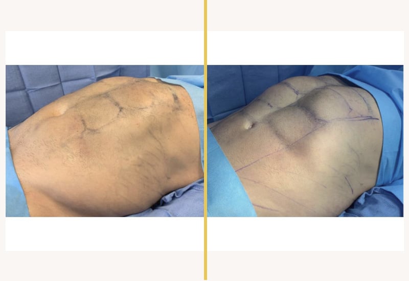case 262