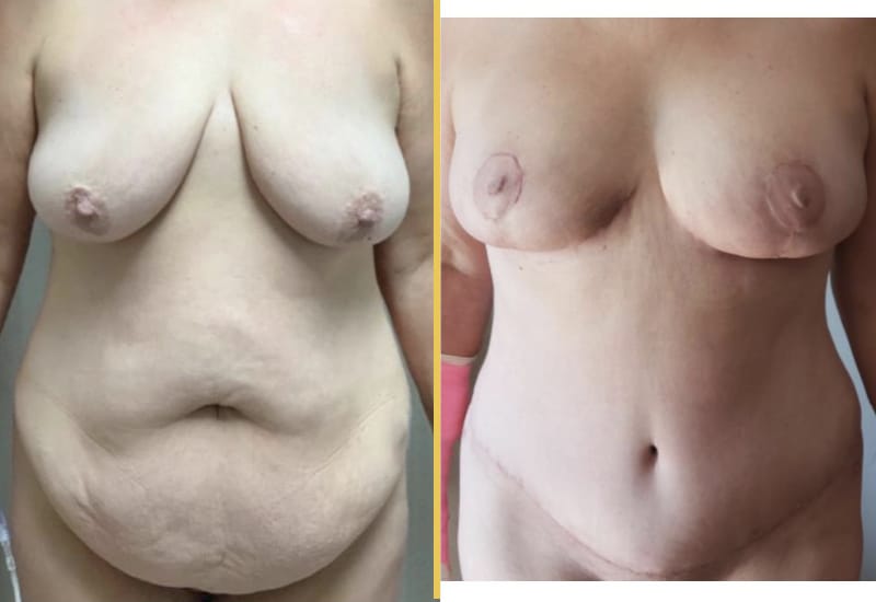 case 270