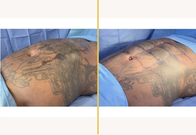 case 293