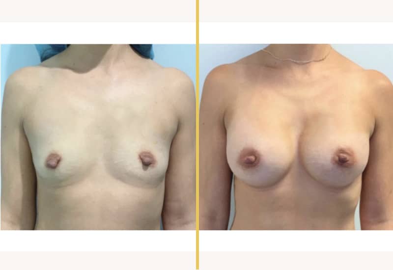 case 207 A
