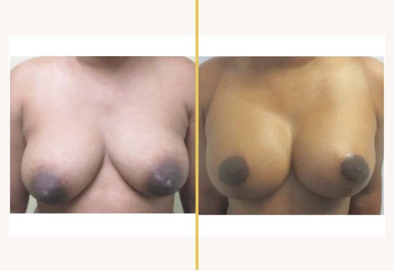 case 235