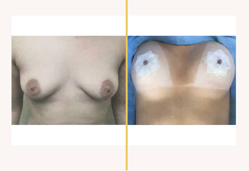 case 293 B